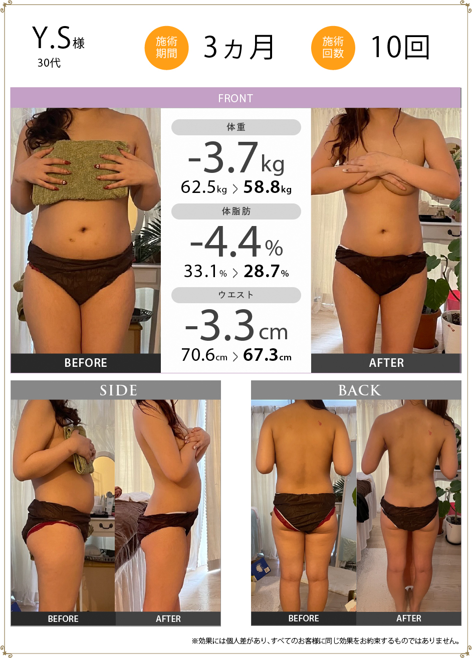 Y.S様50代 施術期間2ヵ月 施術回数6回