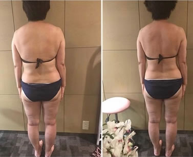 痩身ダイエット